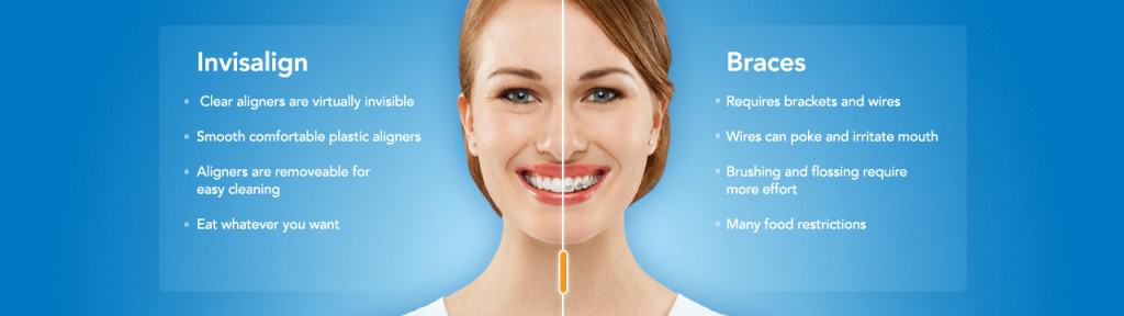 Invisalign Huntington Beach